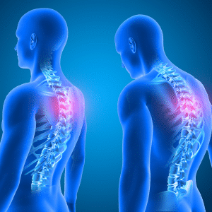 back pain diagrams